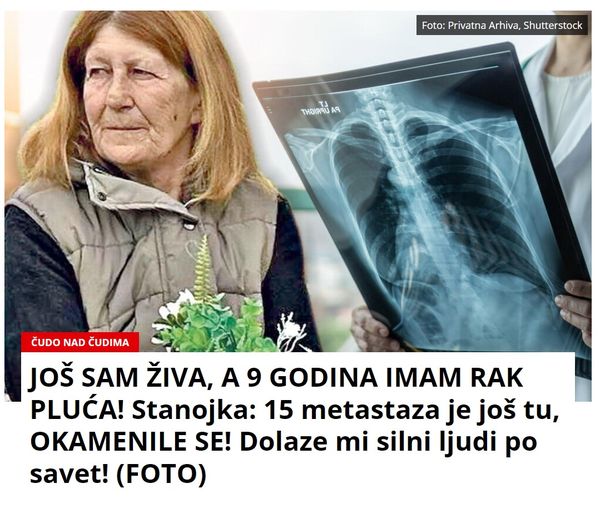 JOŠ SAM ŽIVA, A 9 GODINA IMAM RAK PLUĆA! Stanojka: 15 metastaza je još tu, OKAMENILE SE! Dolaze mi silni ljudi po savet! (FOTO)