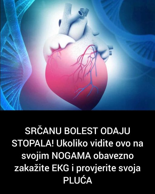 SRČANU BOLEST ODAJU STOPALA! Ukoliko vidite ovo na svojim NOGAMA obavezno zakažite EKG i provjerite svoja PLUĆA