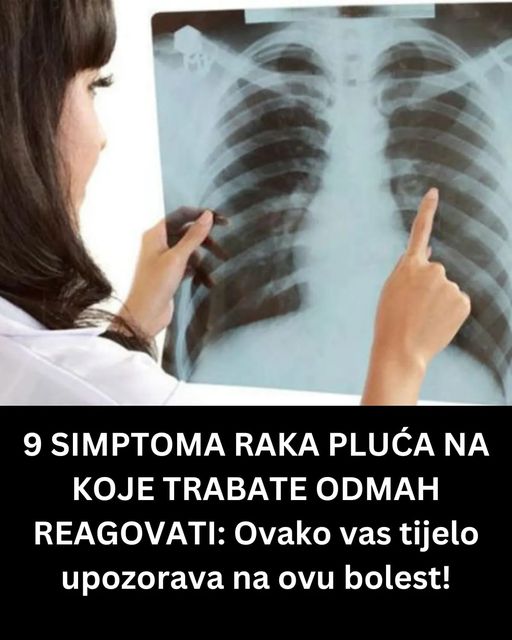 9 SIMPTOMA RAKA PLUĆA NA KOJE TRABATE ODMAH REAGOVATI: Ovako vas tijelo upozorava na ovu bolest!