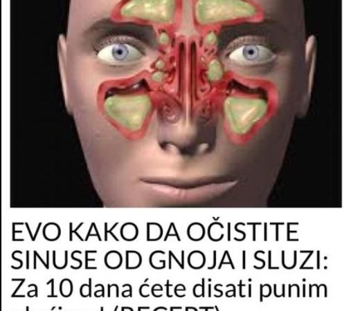 EVO KAKO DA OČISTITE SINUSE OD GNOJA I SLUZI: Za 10 dana ćete disati punim plućima! (RECEPT)