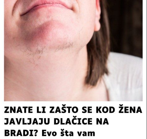 ZNATE LI ZAŠTO SE KOD ŽENA JAVLJAJU DLAČICE NA BRADI?